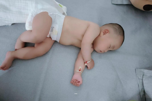 乳山宝宝脸上有白色斑块